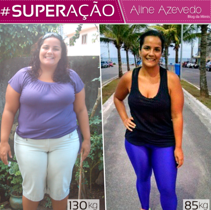 Antes e depois — Aline A. perdeu -45kg