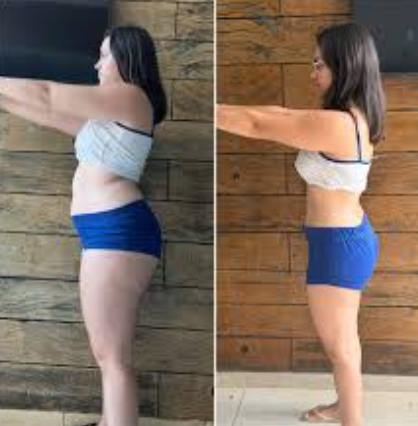 Antes e depois — Mariana S. perdeu -12kg
