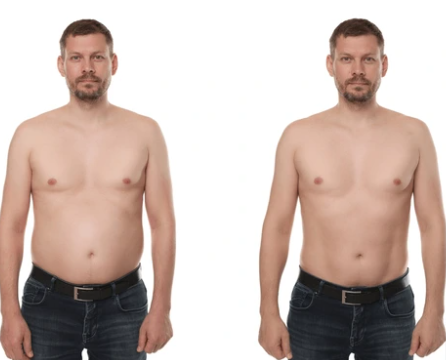 Antes e depois — Carlos M. perdeu -15kg