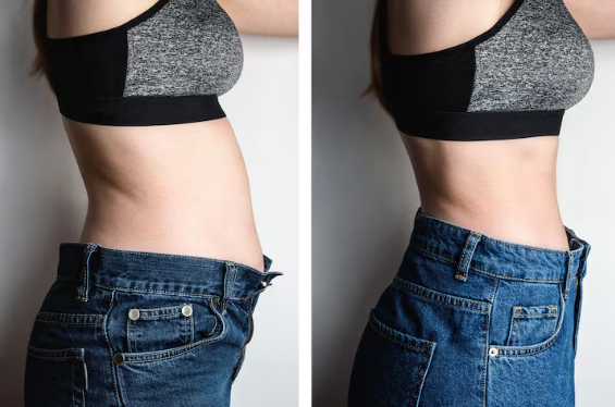 Antes e depois — Patrícia L. perdeu -9kg
